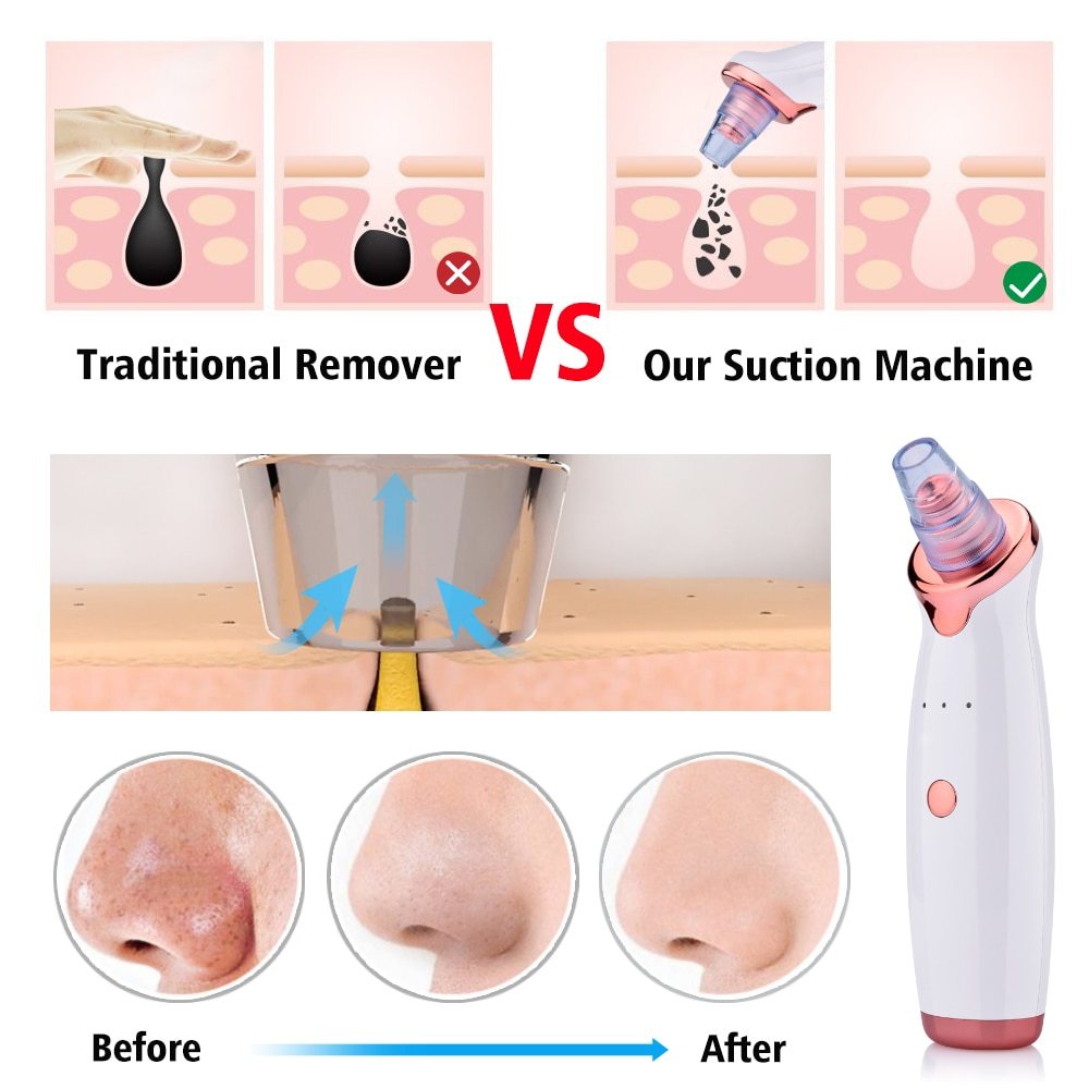 Electric Suction Facial Washing Instrument Beauty