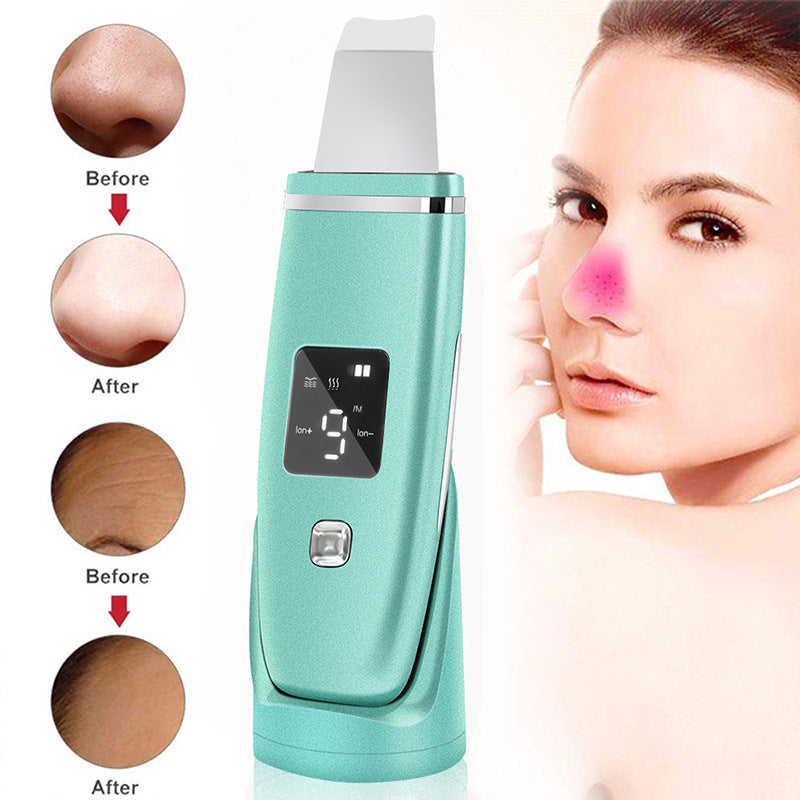 Ultrasonic Vibration Blackhead Remover Deep Cleansing